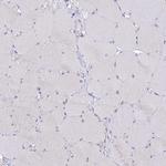 C19orf57 Antibody in Immunohistochemistry (IHC)