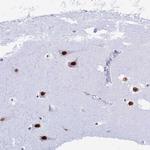 RNPS1 Antibody in Immunohistochemistry (Paraffin) (IHC (P))
