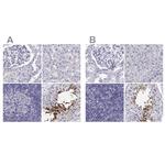 CLPH Polyclonal Antibody