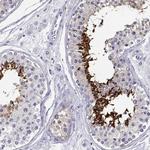 CLPH Antibody in Immunohistochemistry (IHC)