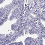CLPH Antibody in Immunohistochemistry (IHC)