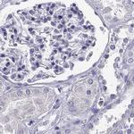 CLPH Antibody in Immunohistochemistry (IHC)