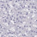 CLPH Antibody in Immunohistochemistry (IHC)