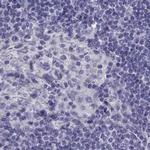 CLPH Antibody in Immunohistochemistry (IHC)