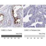 CLPH Antibody