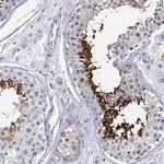 CLPH Antibody in Immunohistochemistry (IHC)