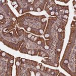 COX11 Polyclonal Antibody