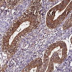 C3orf59 Antibody in Immunohistochemistry (Paraffin) (IHC (P))
