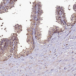 C3orf59 Antibody in Immunohistochemistry (Paraffin) (IHC (P))