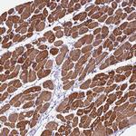 KIAA0408 Antibody in Immunohistochemistry (Paraffin) (IHC (P))
