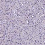 KIAA0408 Polyclonal Antibody
