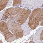 KIAA0408 Antibody in Immunohistochemistry (Paraffin) (IHC (P))