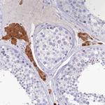 KIAA0408 Antibody in Immunohistochemistry (Paraffin) (IHC (P))