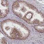 RABL6 Antibody in Immunohistochemistry (Paraffin) (IHC (P))