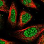 UROS Polyclonal Antibody