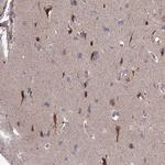UROS Antibody in Immunohistochemistry (Paraffin) (IHC (P))