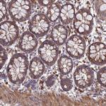UROS Antibody in Immunohistochemistry (Paraffin) (IHC (P))