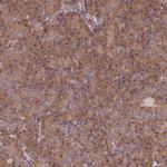 UROS Antibody in Immunohistochemistry (Paraffin) (IHC (P))