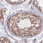 UROS Antibody in Immunohistochemistry (Paraffin) (IHC (P))