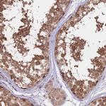 FABP12 Polyclonal Antibody