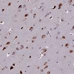 GLYATL3 Polyclonal Antibody