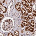 CPSF4L Polyclonal Antibody