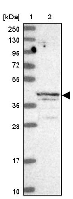 ABH1 Antibody in Western Blot (WB)