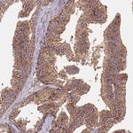 FECH Antibody in Immunohistochemistry (Paraffin) (IHC (P))