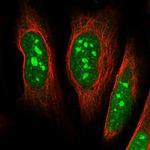 DDX55 Polyclonal Antibody