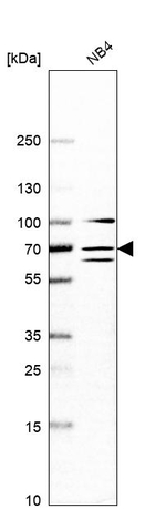 DDX55 Antibody in Western Blot (WB)