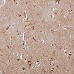 RIMBP2 Polyclonal Antibody