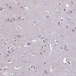 FBRS Antibody in Immunohistochemistry (Paraffin) (IHC (P))