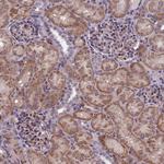 FBRS Antibody in Immunohistochemistry (Paraffin) (IHC (P))