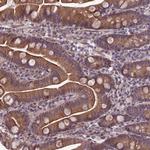 FBRS Antibody in Immunohistochemistry (Paraffin) (IHC (P))