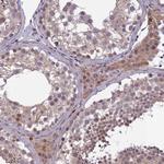 FBRS Antibody in Immunohistochemistry (Paraffin) (IHC (P))
