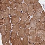 FAM184B Polyclonal Antibody