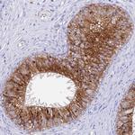 AGTRAP Antibody in Immunohistochemistry (Paraffin) (IHC (P))