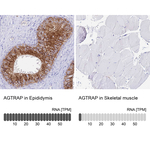AGTRAP Antibody in Immunohistochemistry (Paraffin) (IHC (P))