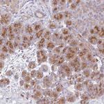 AGTRAP Antibody in Immunohistochemistry (Paraffin) (IHC (P))