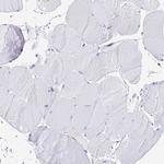 AGTRAP Antibody in Immunohistochemistry (Paraffin) (IHC (P))