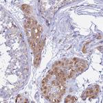 AGTRAP Antibody in Immunohistochemistry (Paraffin) (IHC (P))