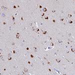 VTI1B Antibody in Immunohistochemistry (Paraffin) (IHC (P))