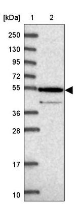 ZNF565 Antibody in Western Blot (WB)