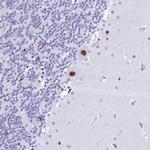 Cdc26 Antibody in Immunohistochemistry (Paraffin) (IHC (P))