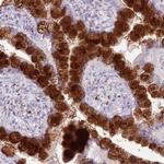 DHDH Polyclonal Antibody