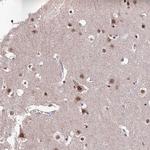THOC7 Antibody in Immunohistochemistry (Paraffin) (IHC (P))