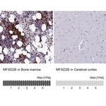 MFSD2B Antibody in Immunohistochemistry (IHC)