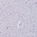 MFSD2B Antibody in Immunohistochemistry (IHC)