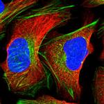 CRTAP Polyclonal Antibody