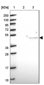 CRTAP Antibody in Western Blot (WB)